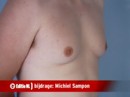 Video: Mannen willen geen borsten
